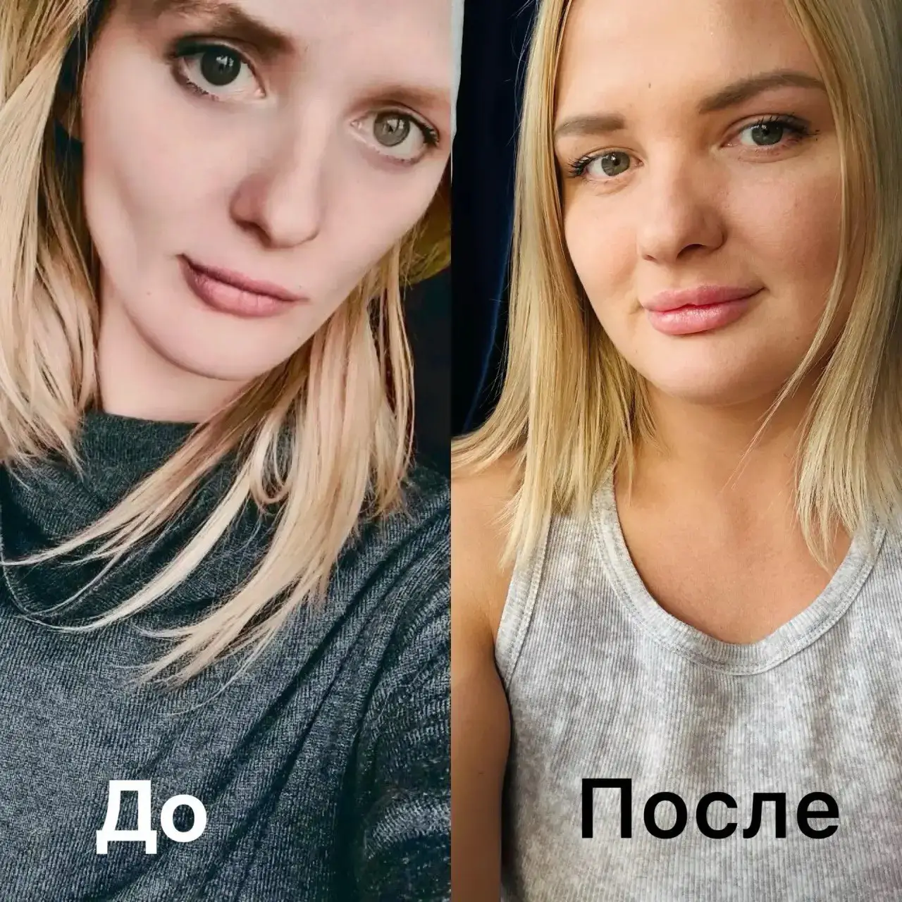 Реальная фотография до и после прохождения программы центра
